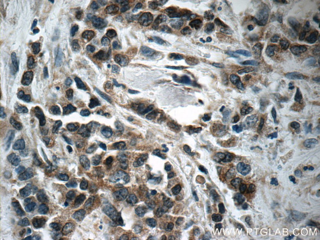 Pepsinogen I Antibody in Immunohistochemistry (Paraffin) (IHC (P))