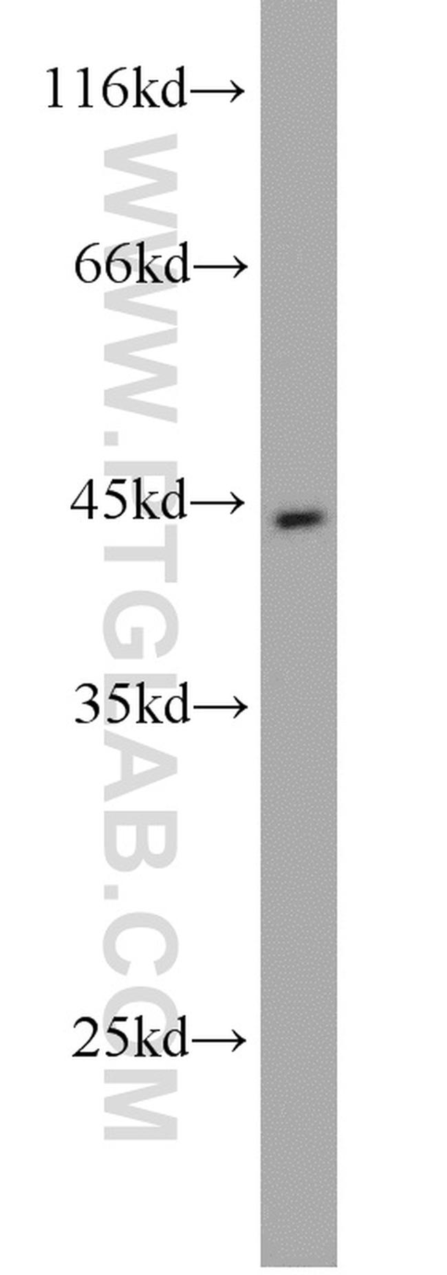 Pepsinogen I Antibody in Western Blot (WB)