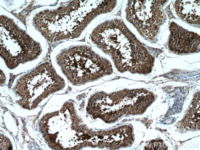 LIPE Antibody in Immunohistochemistry (Paraffin) (IHC (P))