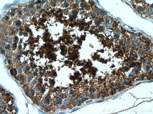 LIPE Antibody in Immunohistochemistry (Paraffin) (IHC (P))