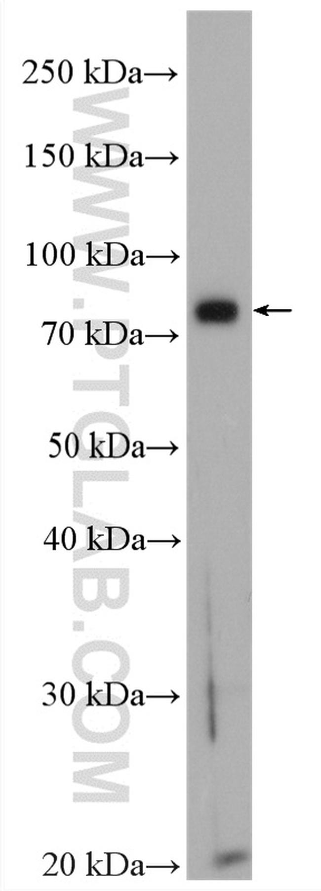 LIPE Antibody in Western Blot (WB)