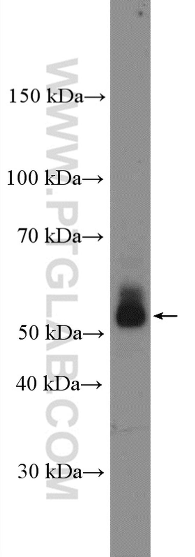 CD1d Antibody in Western Blot (WB)