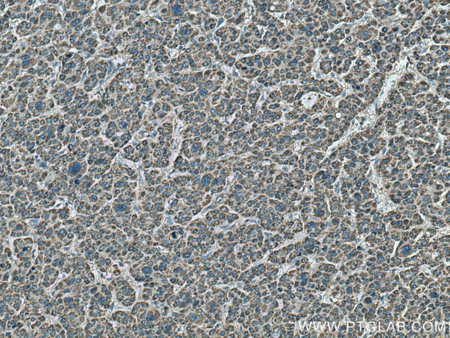 MEK4 Antibody in Immunohistochemistry (Paraffin) (IHC (P))