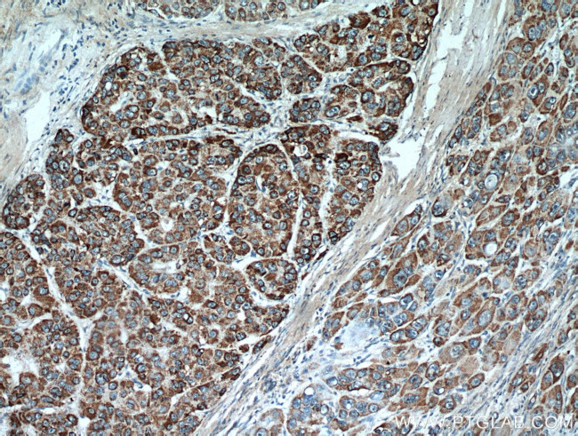 MEK4 Antibody in Immunohistochemistry (Paraffin) (IHC (P))