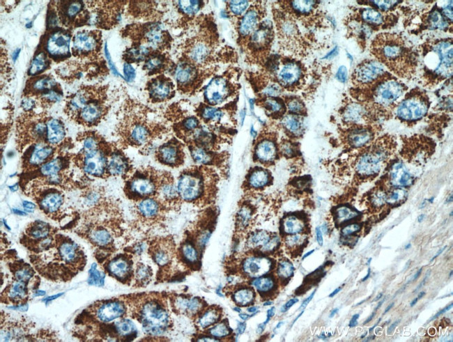 MEK4 Antibody in Immunohistochemistry (Paraffin) (IHC (P))