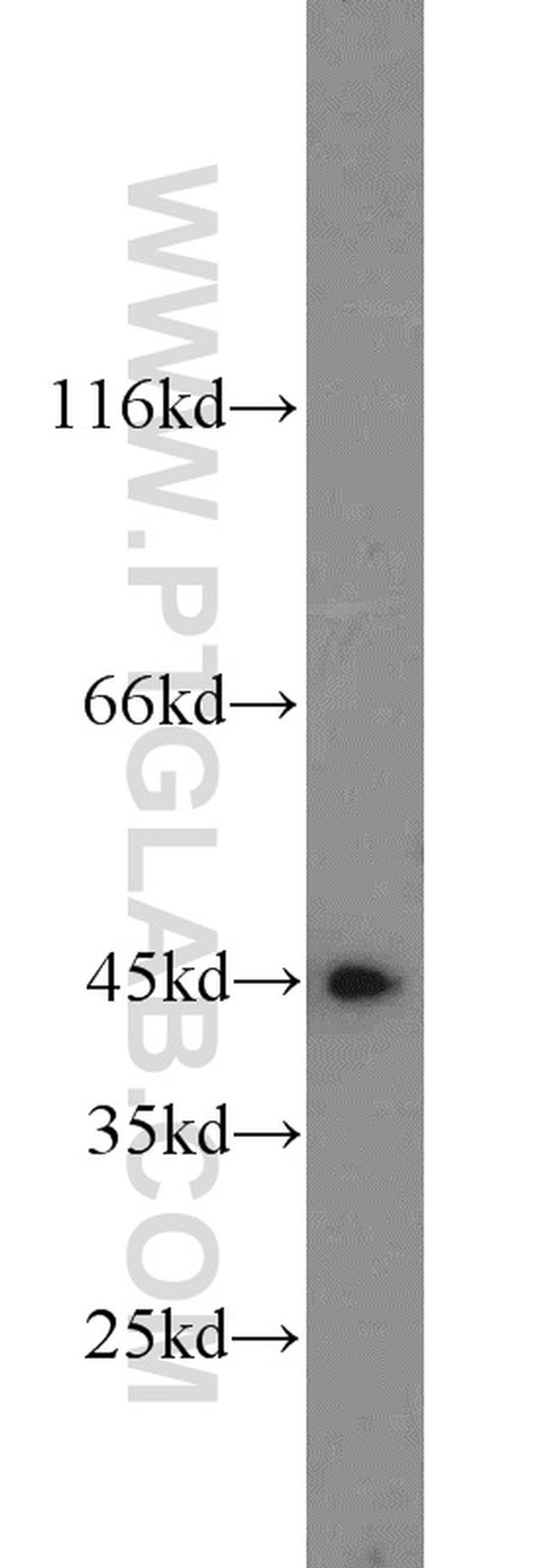 MEK4 Antibody in Western Blot (WB)