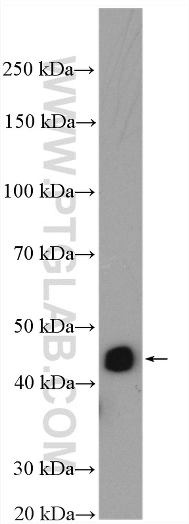 MEK4 Antibody in Western Blot (WB)