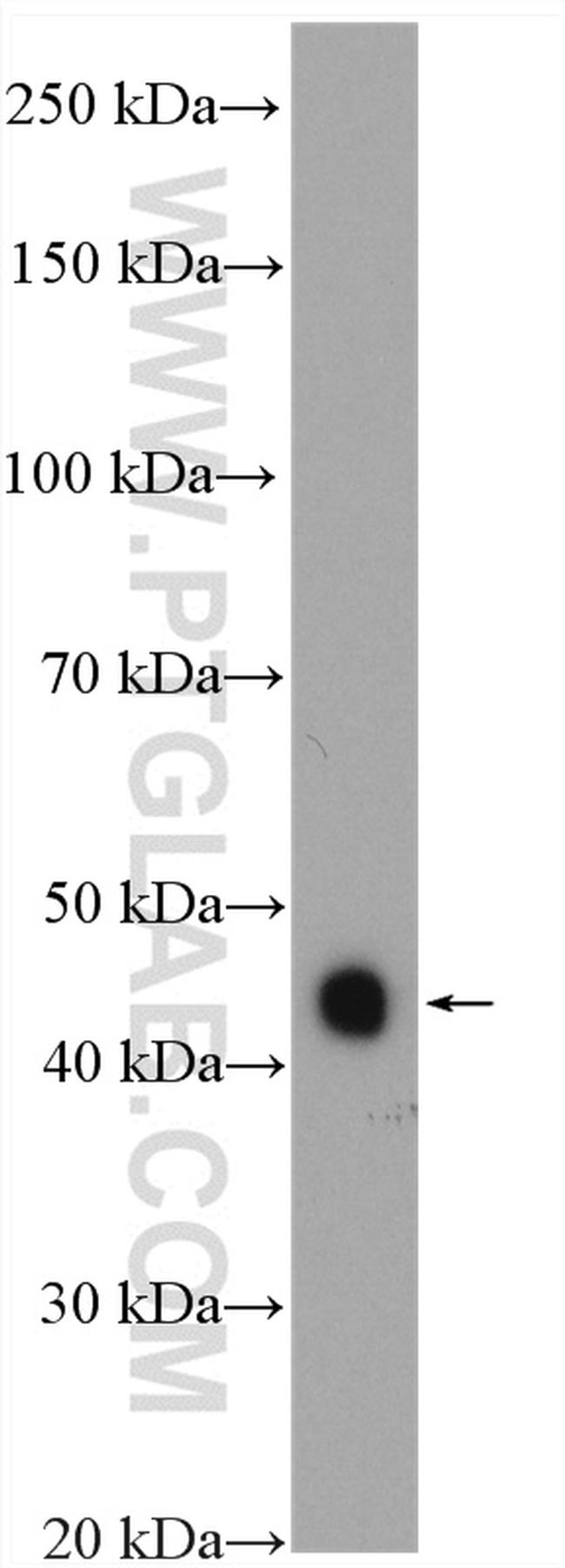 MEK4 Antibody in Western Blot (WB)