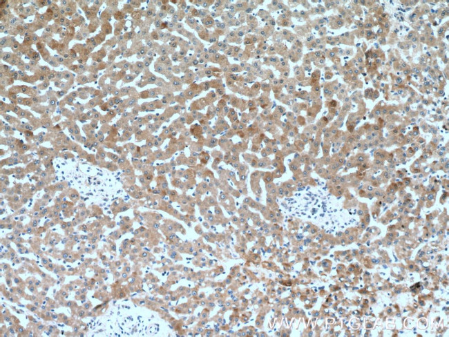 C1R Antibody in Immunohistochemistry (Paraffin) (IHC (P))