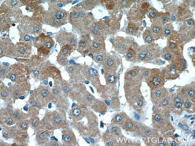 C1R Antibody in Immunohistochemistry (Paraffin) (IHC (P))