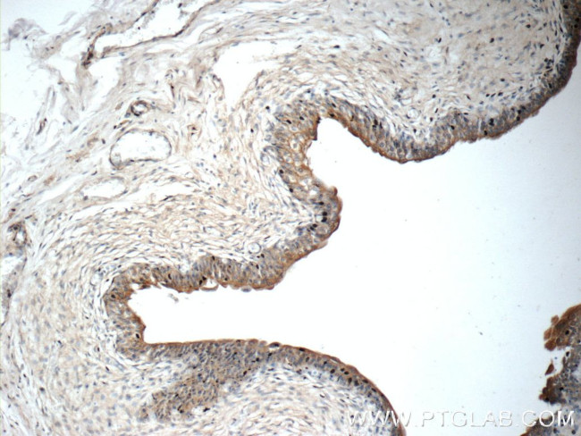 SDR42E1 Antibody in Immunohistochemistry (Paraffin) (IHC (P))