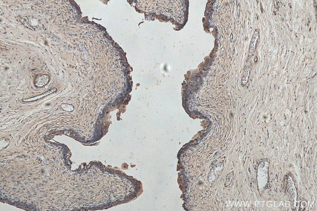 SDR42E1 Antibody in Immunohistochemistry (Paraffin) (IHC (P))