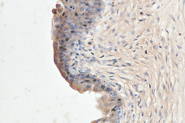 SDR42E1 Antibody in Immunohistochemistry (Paraffin) (IHC (P))