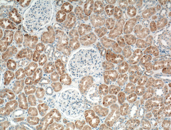 TIMP-2 Antibody in Immunohistochemistry (Paraffin) (IHC (P))