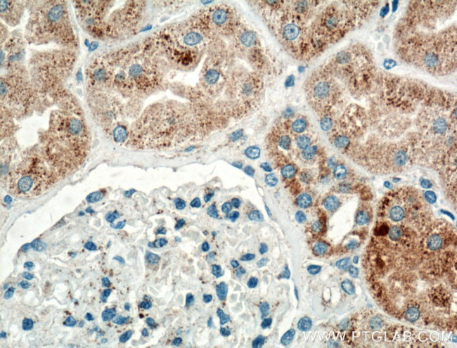 TIMP-2 Antibody in Immunohistochemistry (Paraffin) (IHC (P))