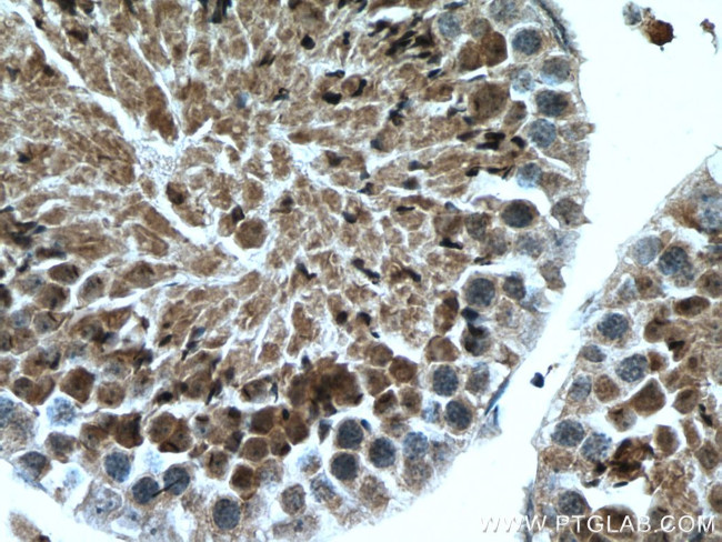 ACTL7A Antibody in Immunohistochemistry (Paraffin) (IHC (P))