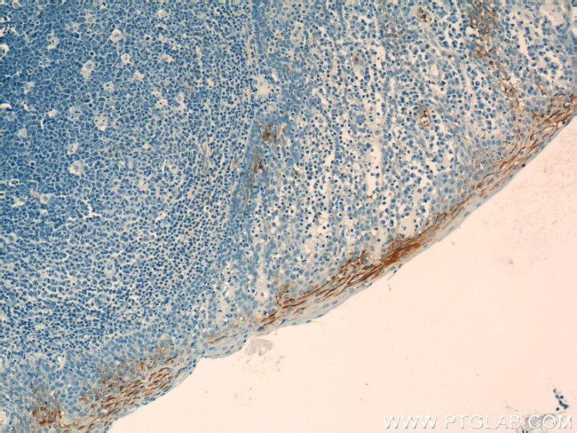 LY6D Antibody in Immunohistochemistry (Paraffin) (IHC (P))