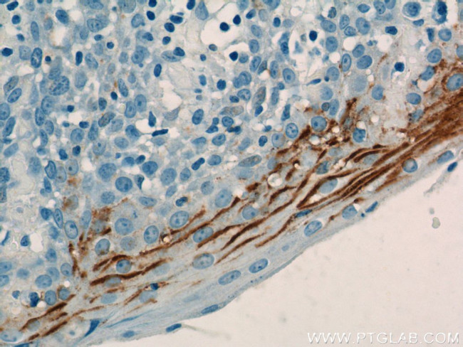 LY6D Antibody in Immunohistochemistry (Paraffin) (IHC (P))