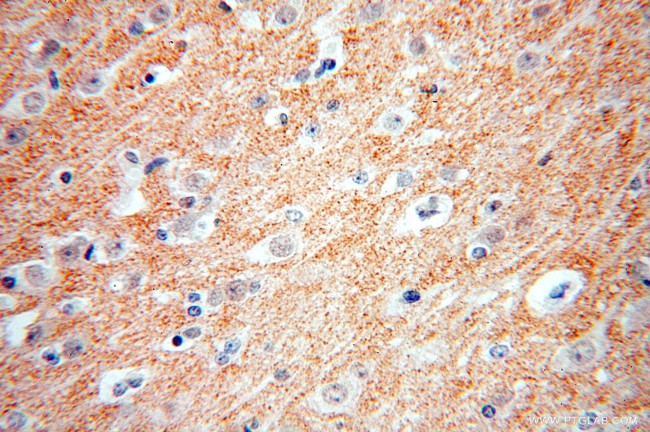 ZnT3 Antibody in Immunohistochemistry (Paraffin) (IHC (P))