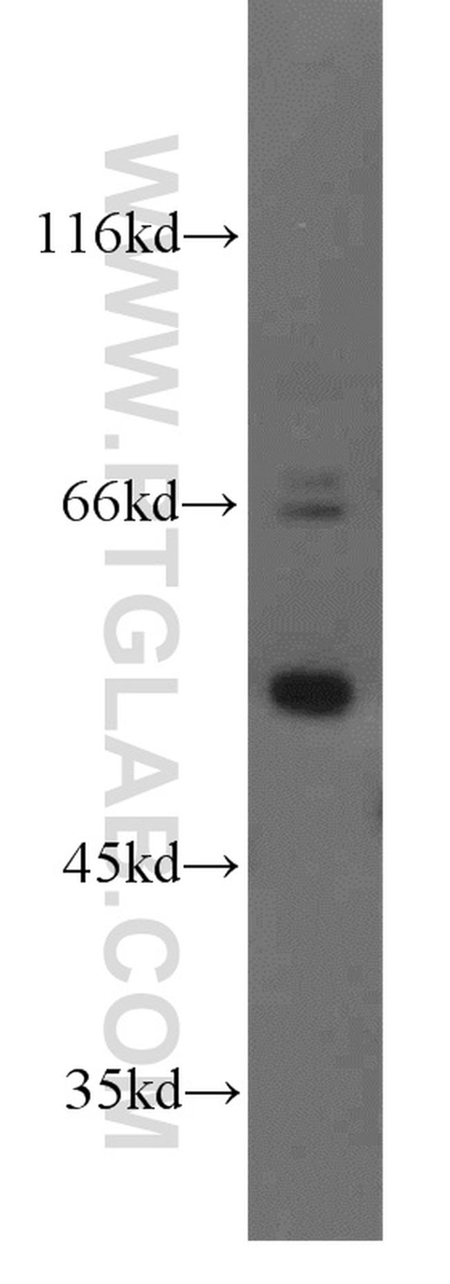 TADA2B Antibody in Western Blot (WB)