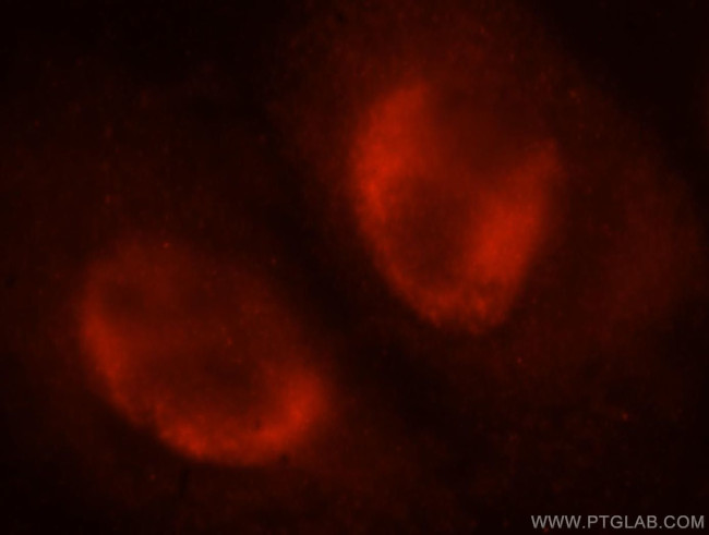 SNRPA1 Antibody in Immunocytochemistry (ICC/IF)