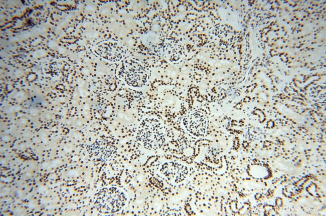 SNRPA1 Antibody in Immunohistochemistry (Paraffin) (IHC (P))