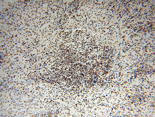 SNRPA1 Antibody in Immunohistochemistry (Paraffin) (IHC (P))