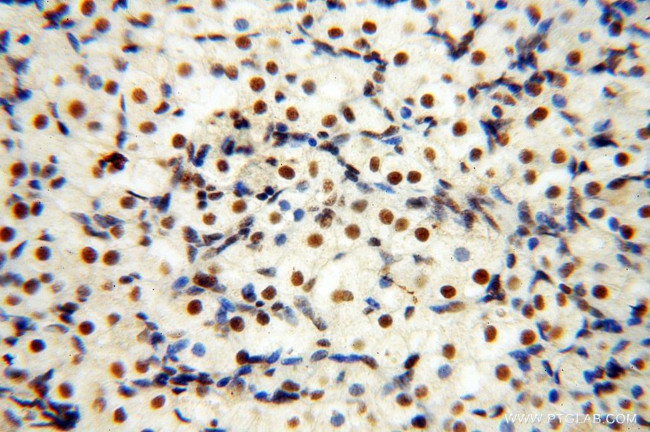 SNRPA1 Antibody in Immunohistochemistry (Paraffin) (IHC (P))