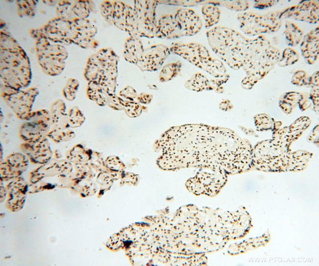 SNRPA1 Antibody in Immunohistochemistry (Paraffin) (IHC (P))