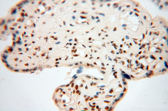 SNRPA1 Antibody in Immunohistochemistry (Paraffin) (IHC (P))