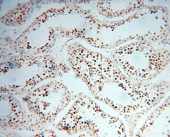 SNRPA1 Antibody in Immunohistochemistry (Paraffin) (IHC (P))