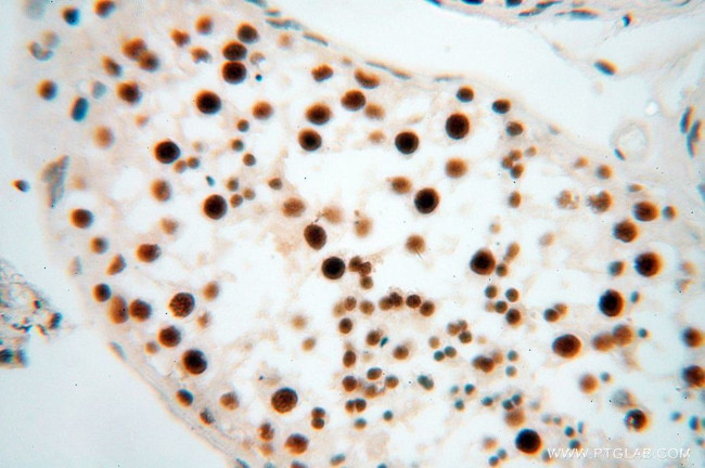 SNRPA1 Antibody in Immunohistochemistry (Paraffin) (IHC (P))