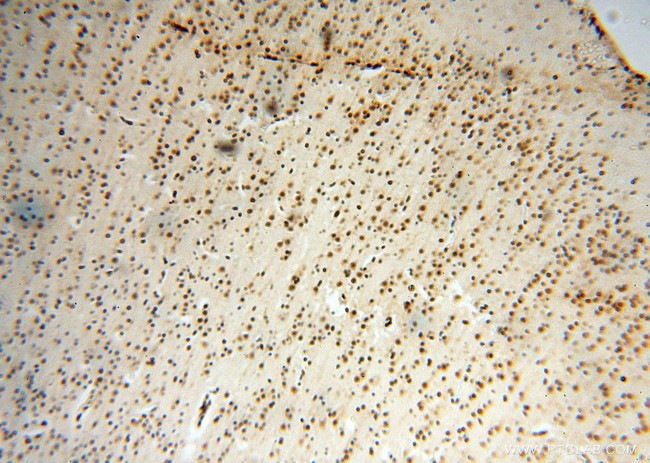 SNRPA1 Antibody in Immunohistochemistry (Paraffin) (IHC (P))