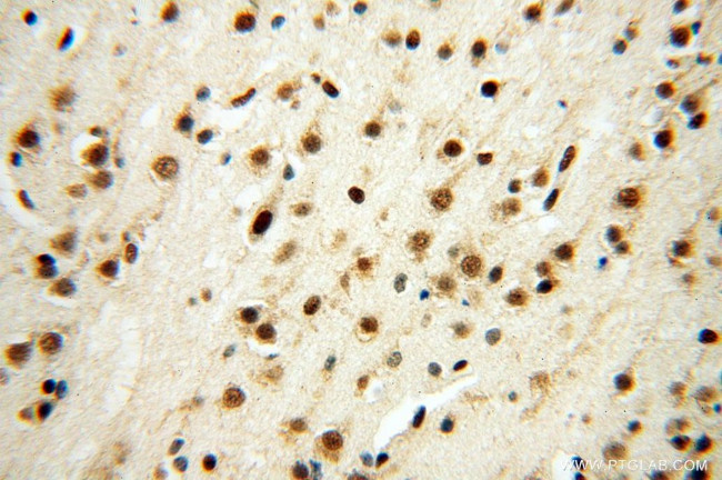 SNRPA1 Antibody in Immunohistochemistry (Paraffin) (IHC (P))