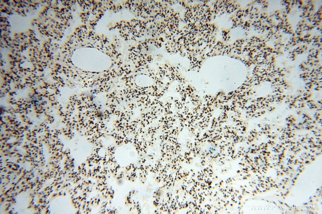 SNRPA1 Antibody in Immunohistochemistry (Paraffin) (IHC (P))