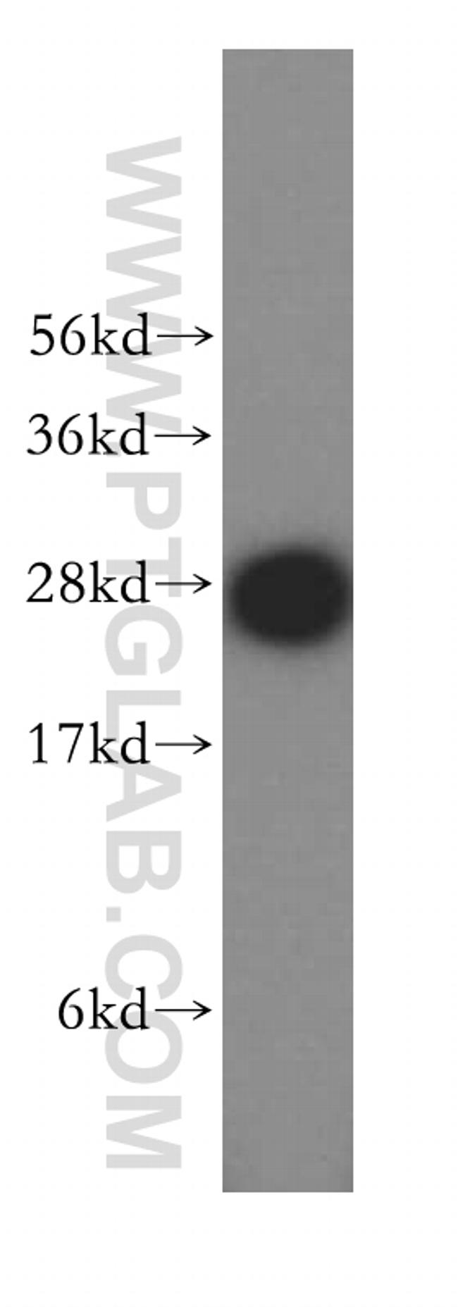 SNRPA1 Antibody in Western Blot (WB)