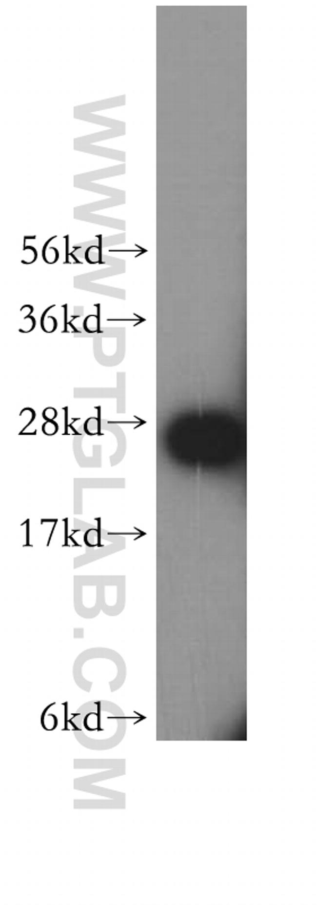 SNRPA1 Antibody in Western Blot (WB)