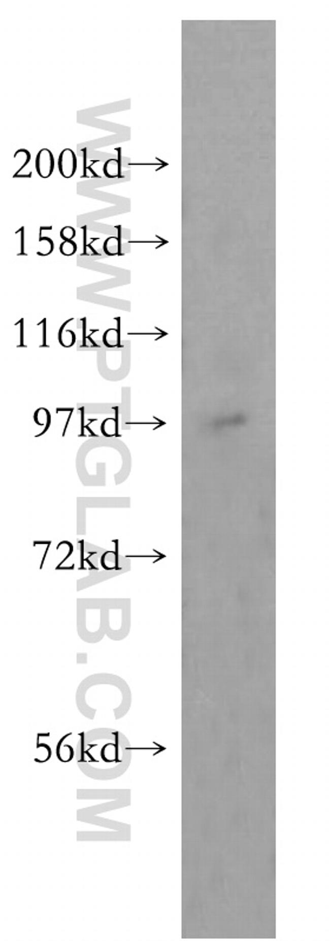 TEX10 Antibody in Western Blot (WB)