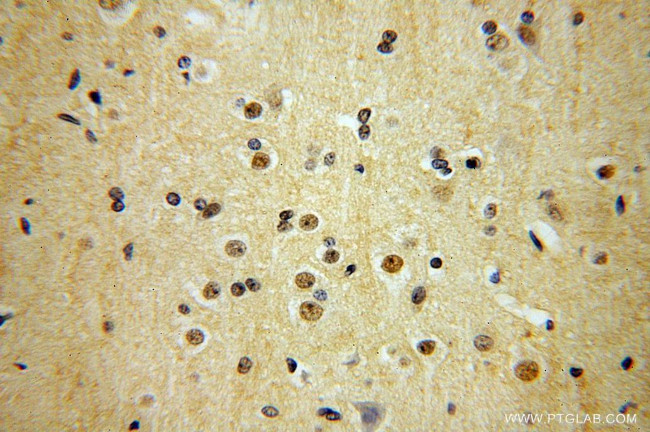 TEX10 Antibody in Immunohistochemistry (Paraffin) (IHC (P))