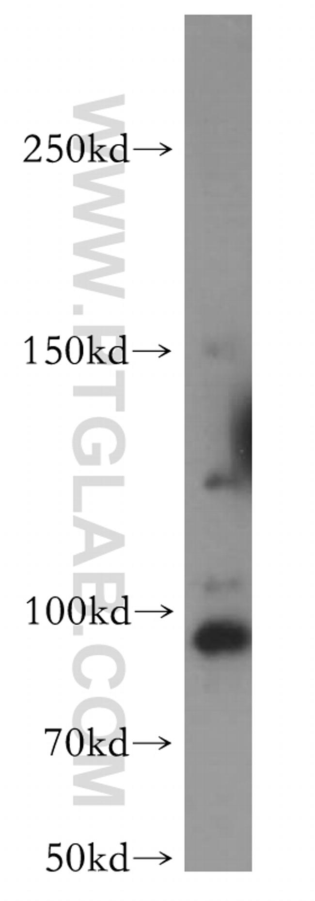 TEX10 Antibody in Western Blot (WB)