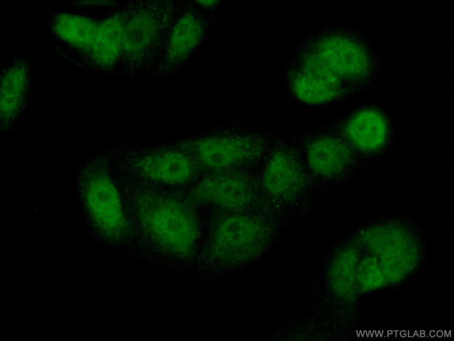 PADI4 Antibody in Immunocytochemistry (ICC/IF)