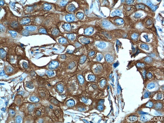 PADI4 Antibody in Immunohistochemistry (Paraffin) (IHC (P))