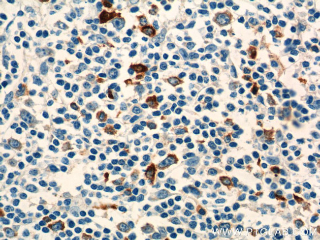 PADI4 Antibody in Immunohistochemistry (Paraffin) (IHC (P))