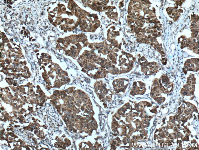 PADI4 Antibody in Immunohistochemistry (Paraffin) (IHC (P))