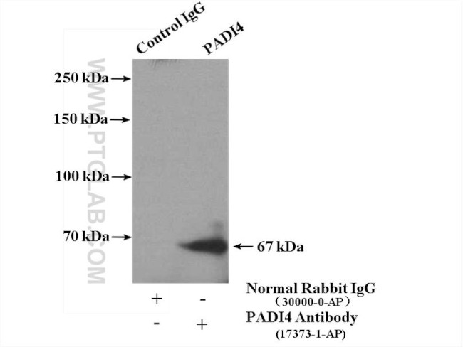 PADI4 Antibody in Immunoprecipitation (IP)