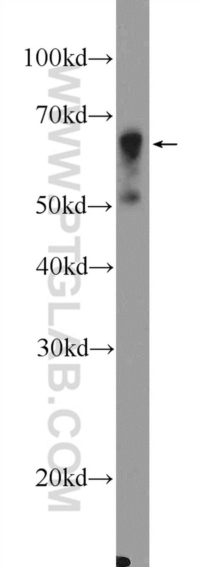 PADI4 Antibody in Western Blot (WB)