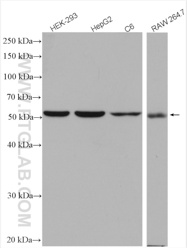 PADI4 Antibody in Western Blot (WB)