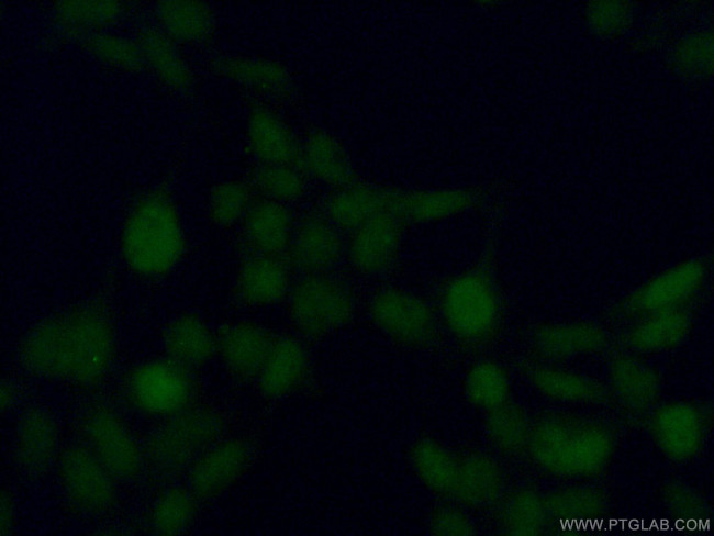 MAPK11 Antibody in Immunocytochemistry (ICC/IF)