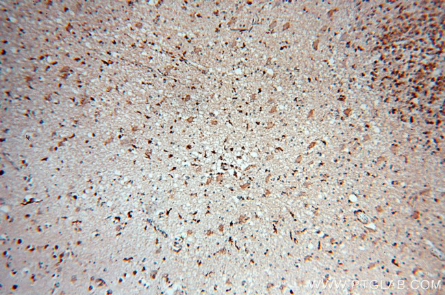 MAPK11 Antibody in Immunohistochemistry (Paraffin) (IHC (P))