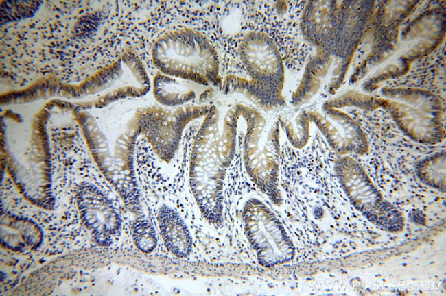 PIGZ Antibody in Immunohistochemistry (Paraffin) (IHC (P))